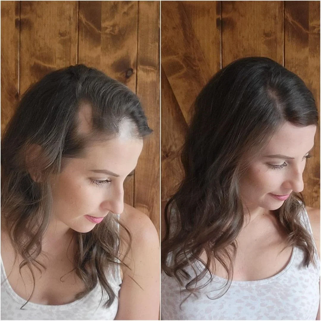 UniWigs Hair Patches 1